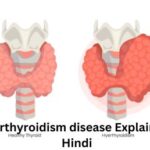 Hyperthyroidism disease Explained In Hindi